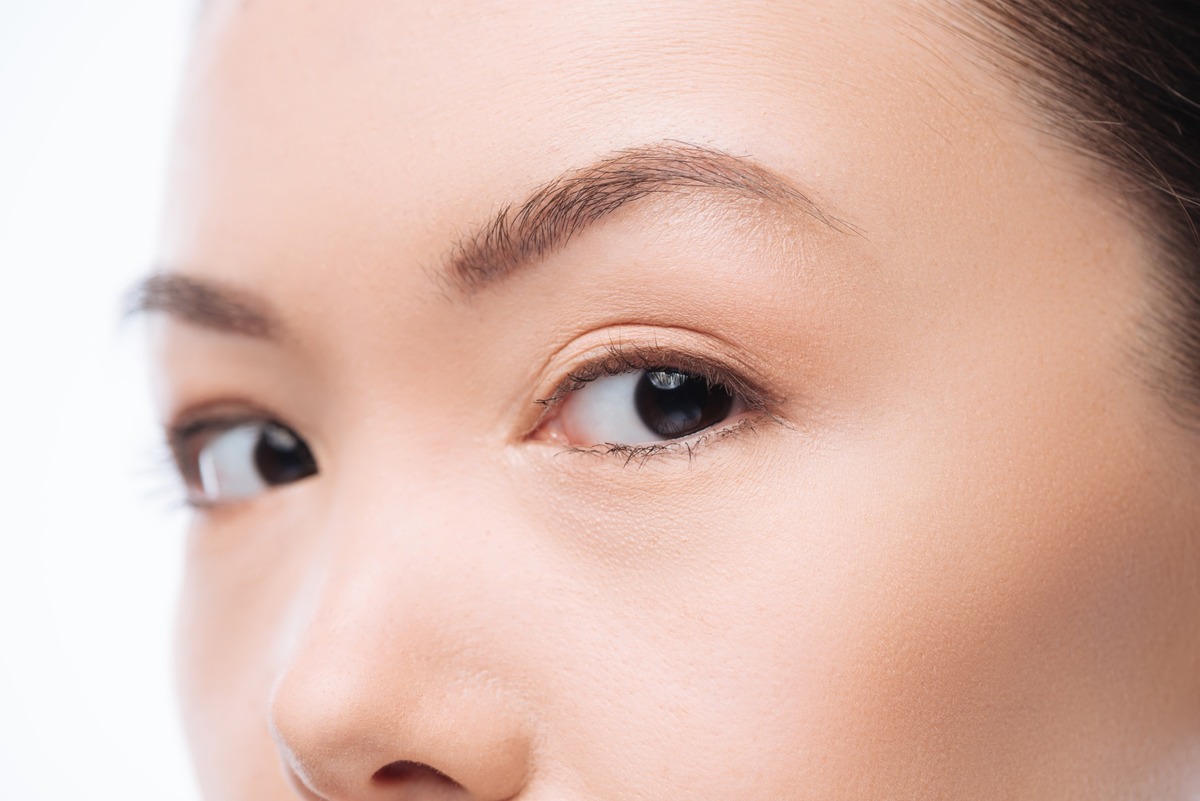 Блефаропластика азиатских глаз (сингапури)