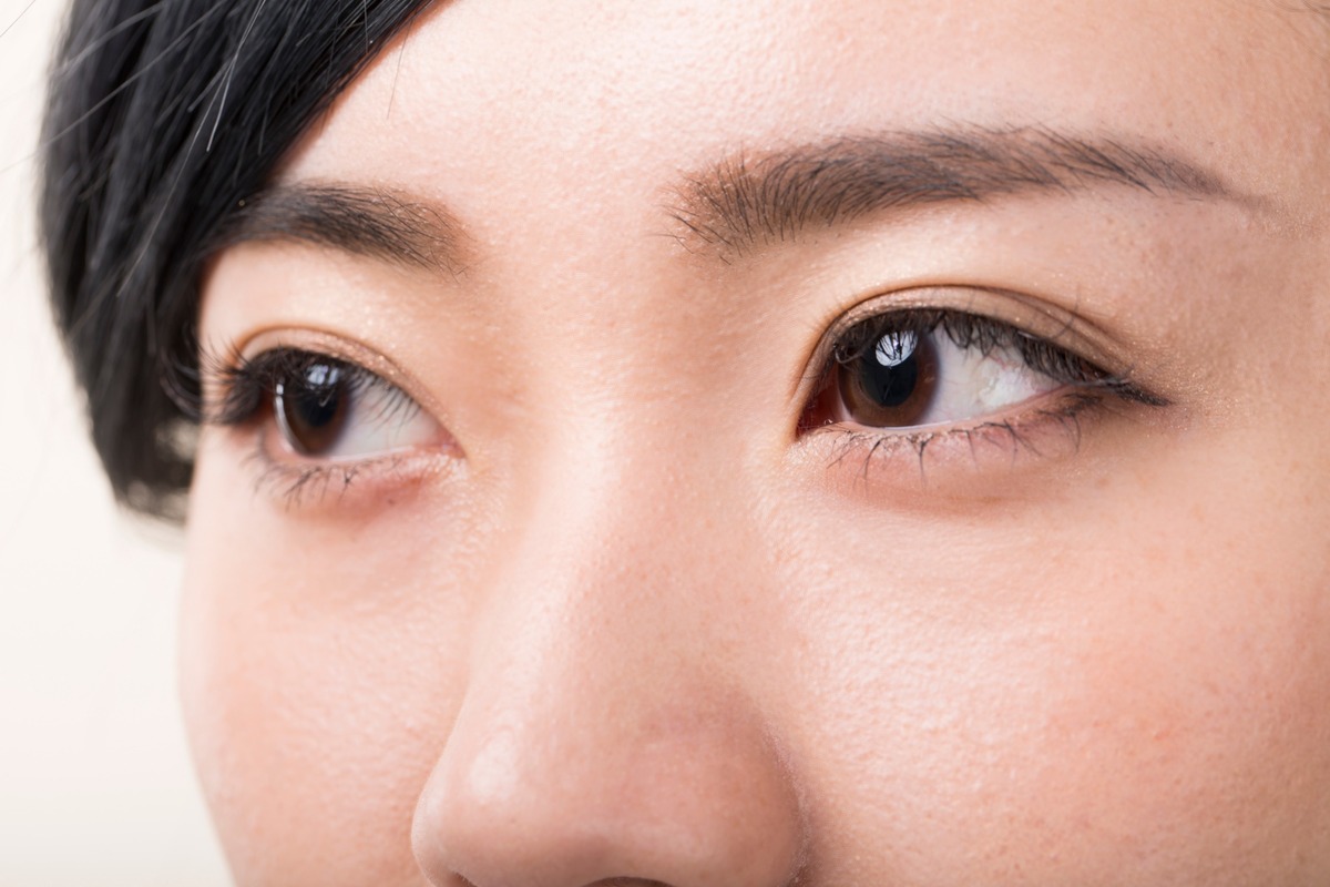 Блефаропластика под местной анестезией