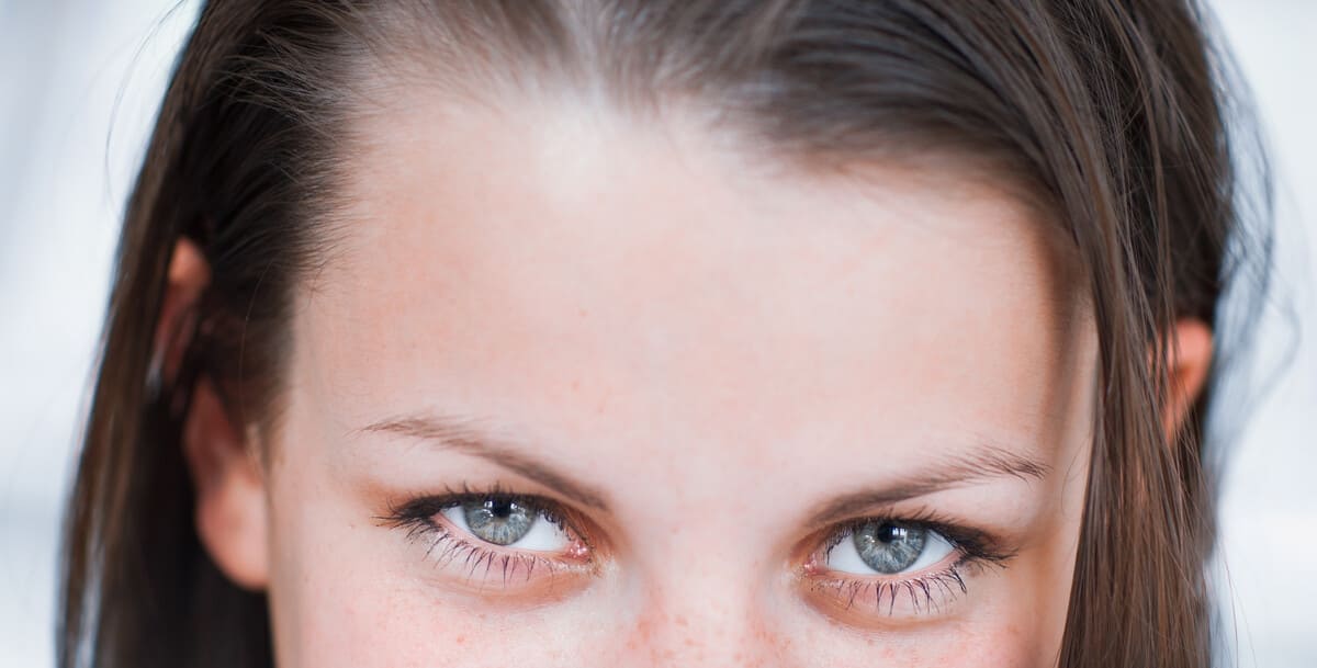 Подтяжка лба