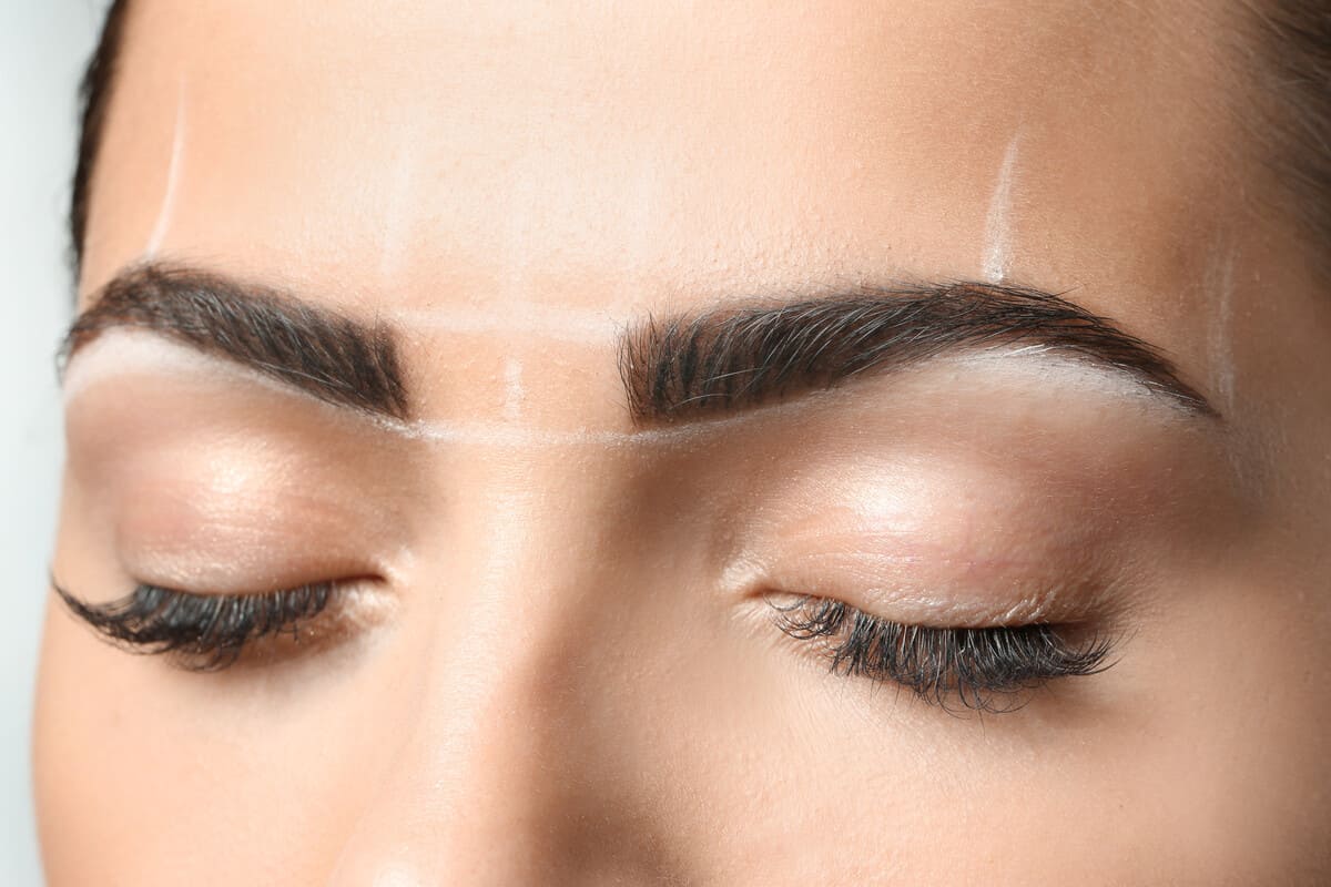 Подтяжка лба