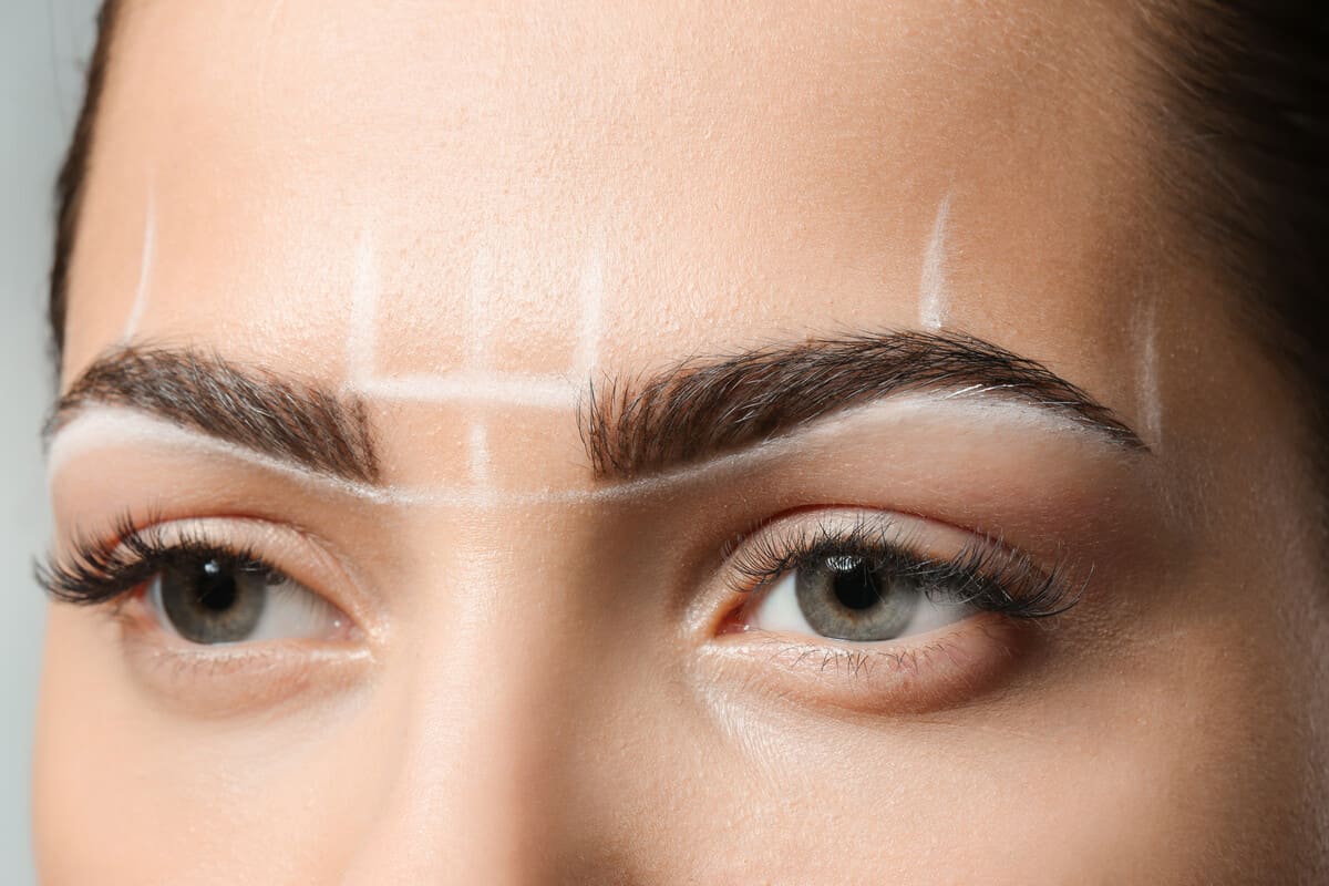 Подтяжка лба