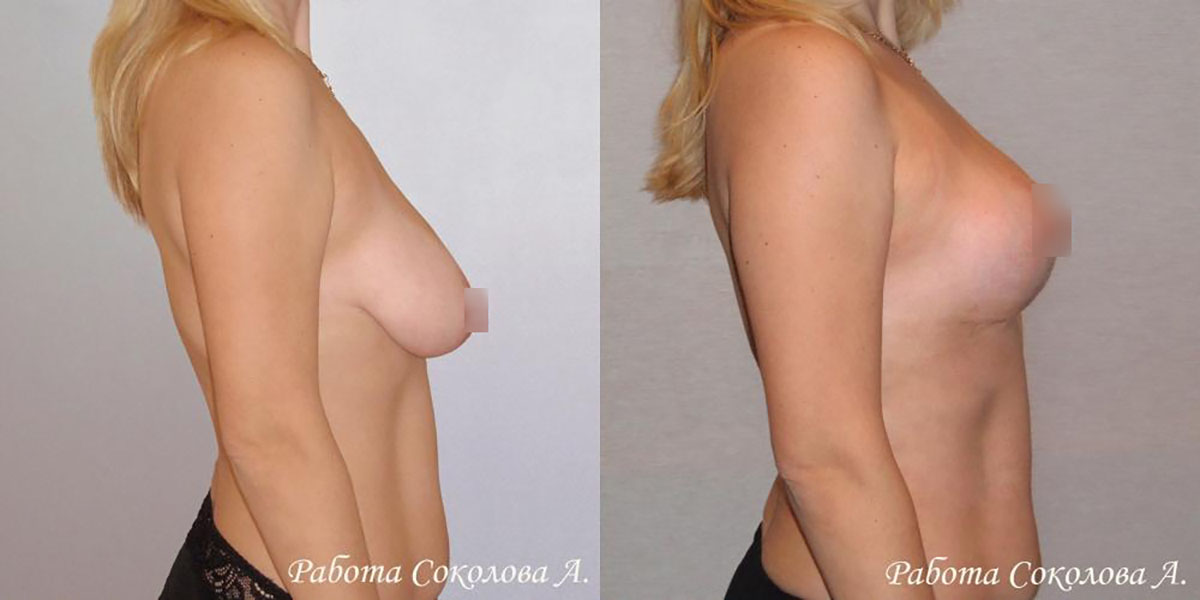 Пластическая хирургия