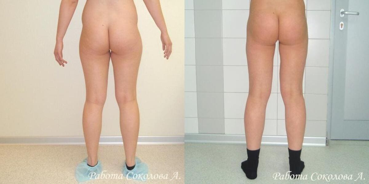 Пластическая операция