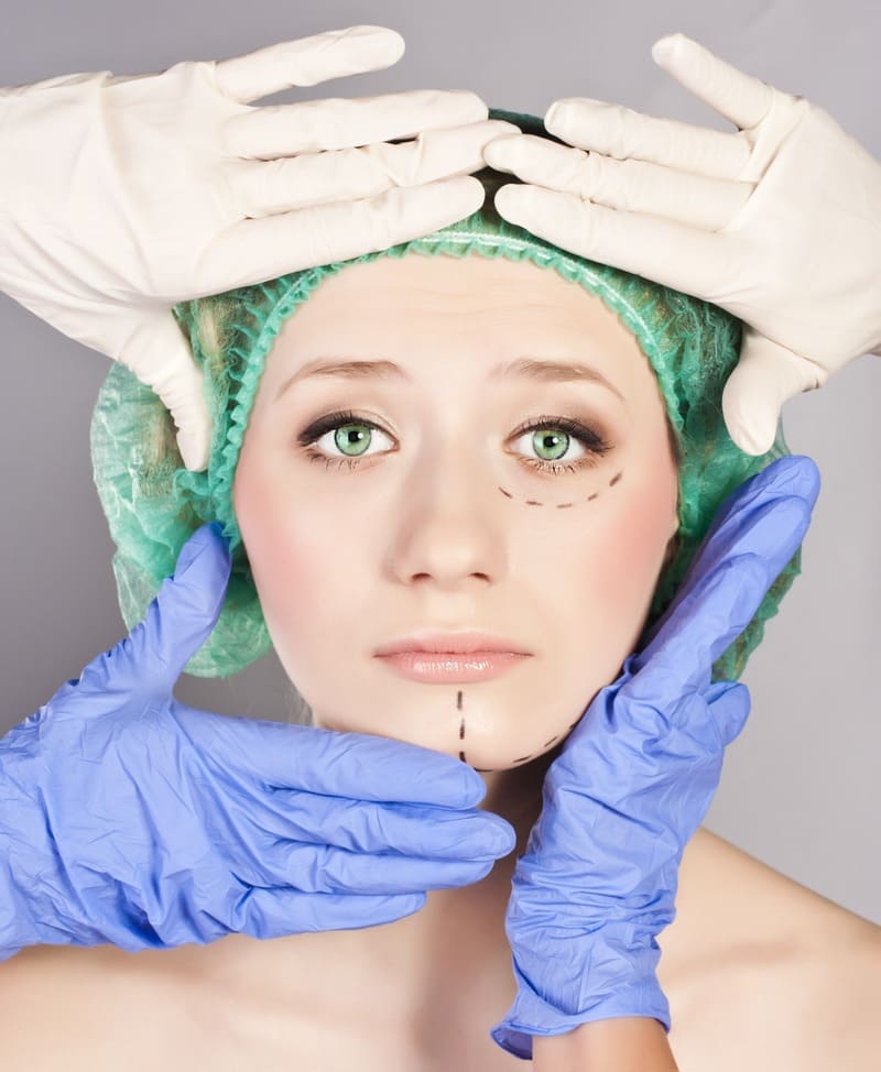 Результат блефаропластики