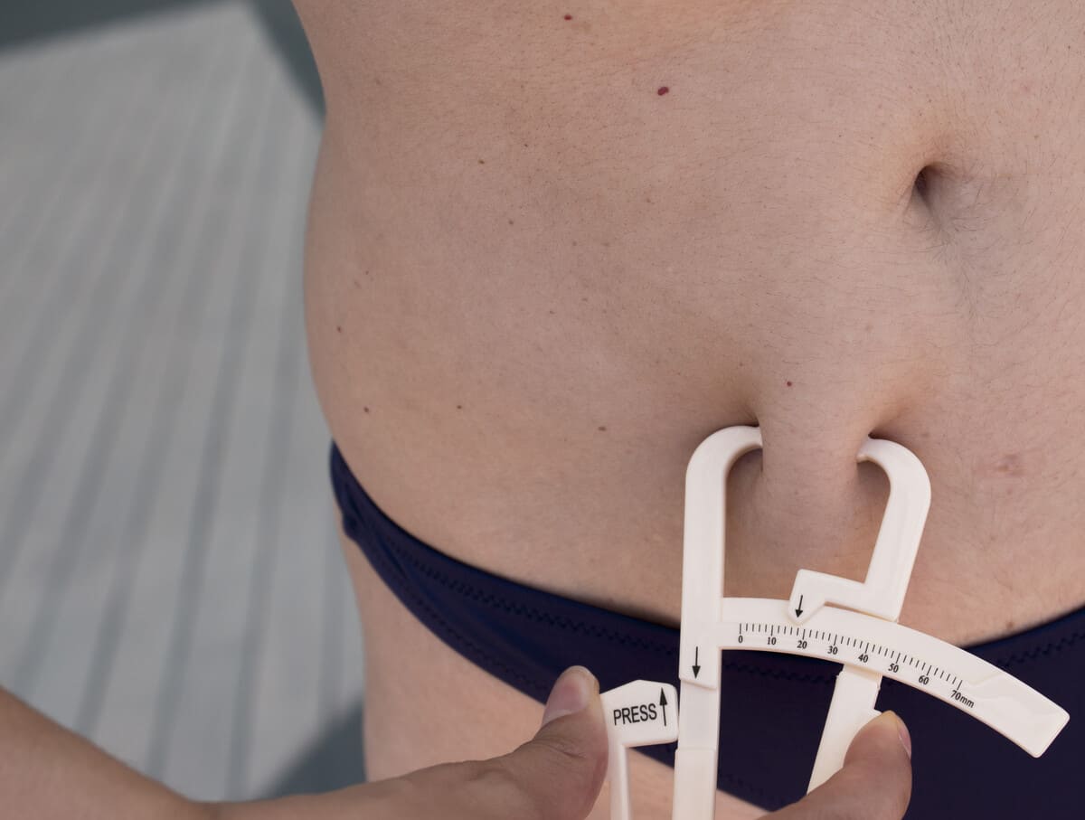 Липосакция