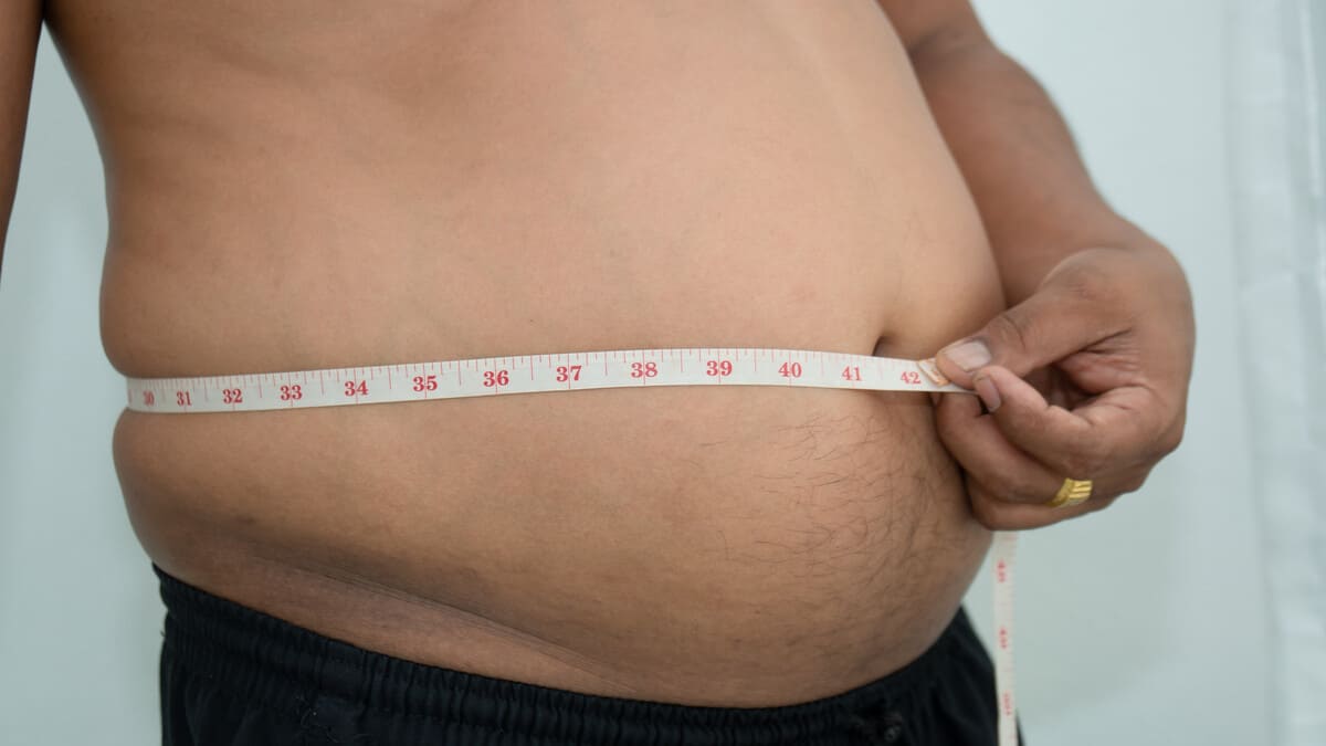 Липосакция живота у мужчин