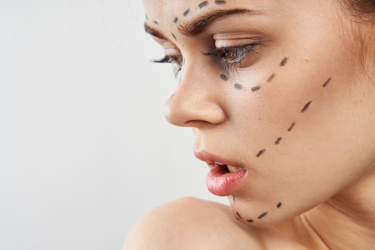 Подтяжка лица