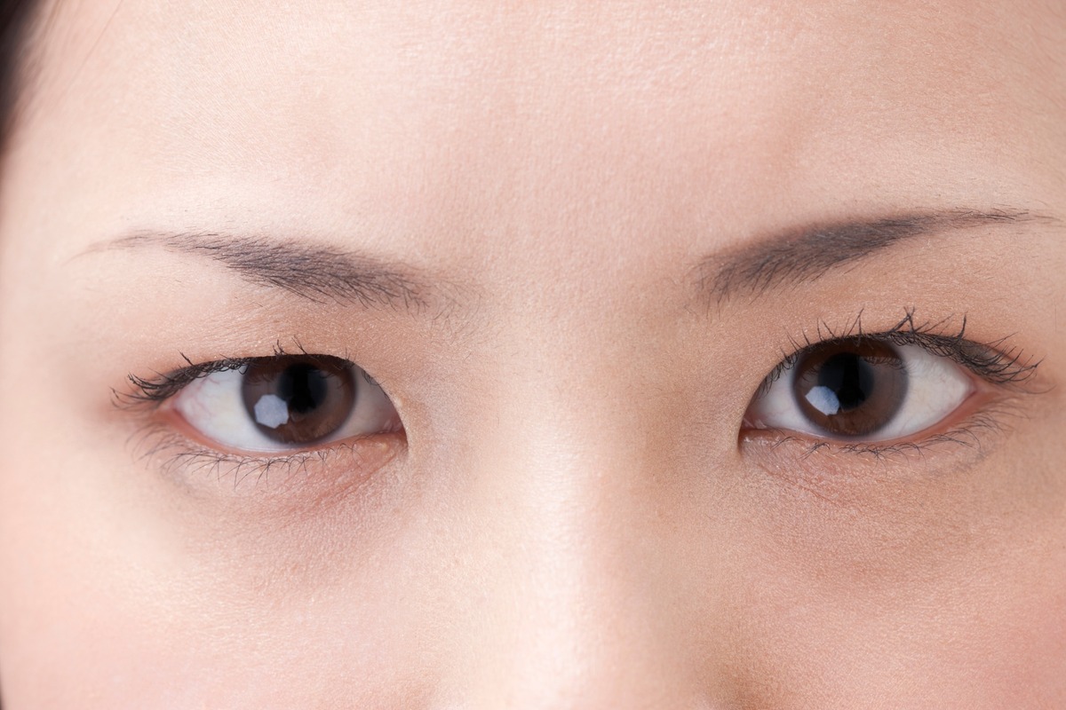 Ориентальная пластика век