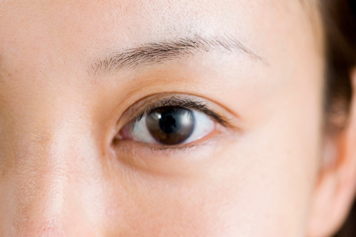 Ориентальная пластика век