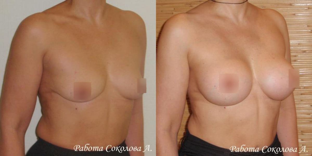 Пластическая хирургия