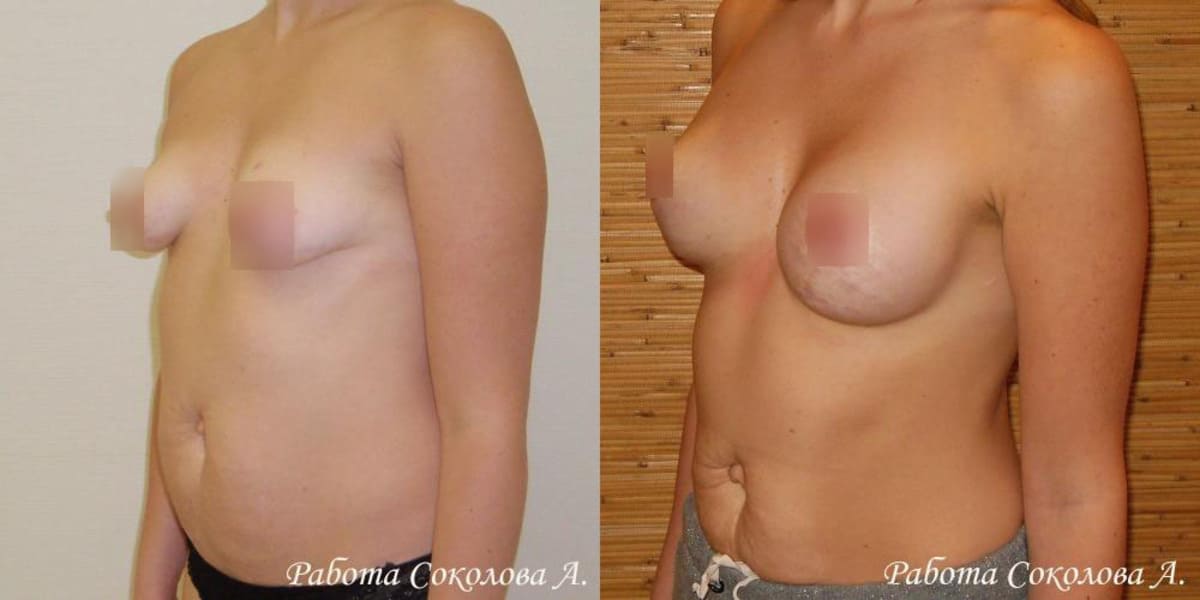 Пластическая хирургия