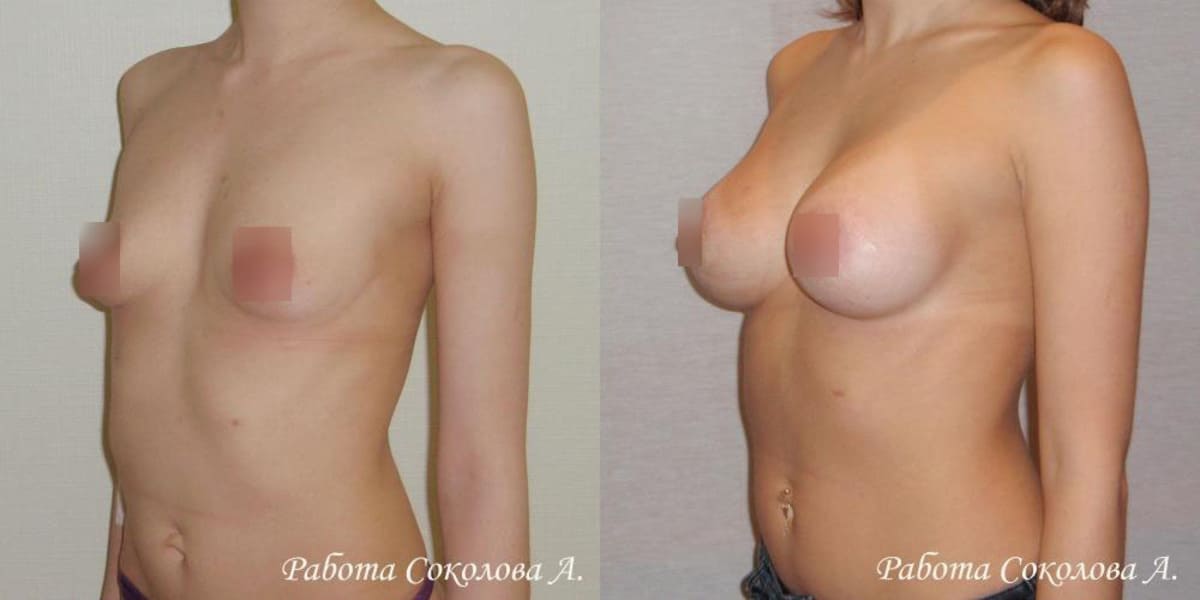 Пластическая хирургия