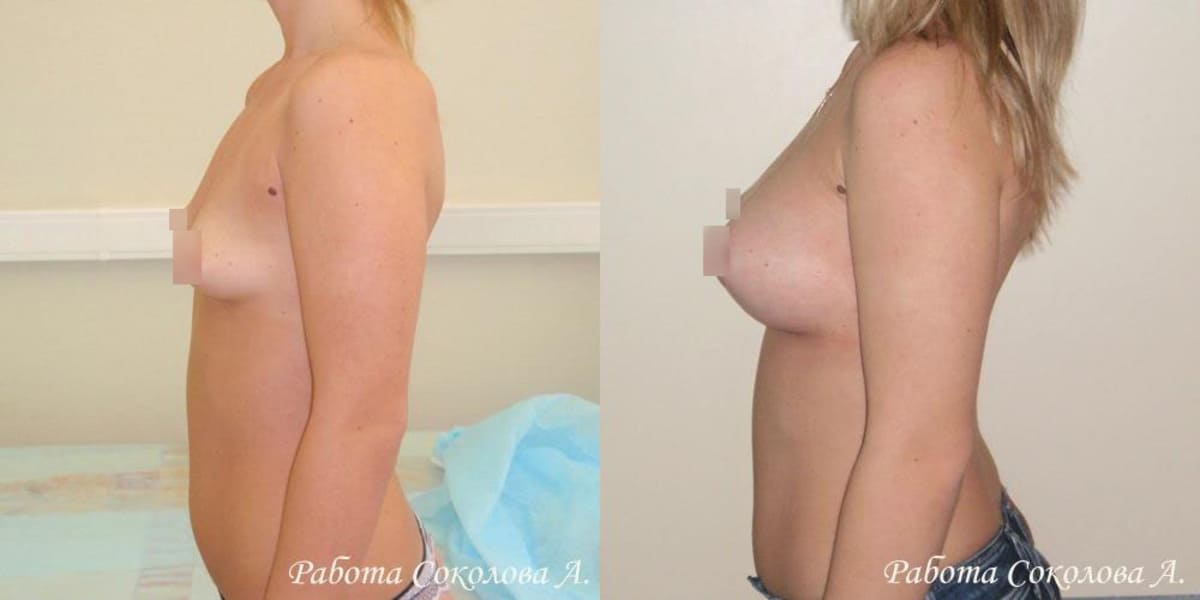 Пластическая хирургия