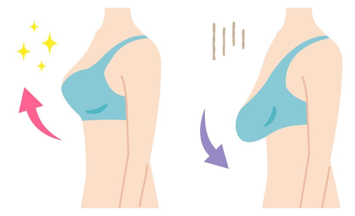 Что делать, если грудь смотрит в разные стороны