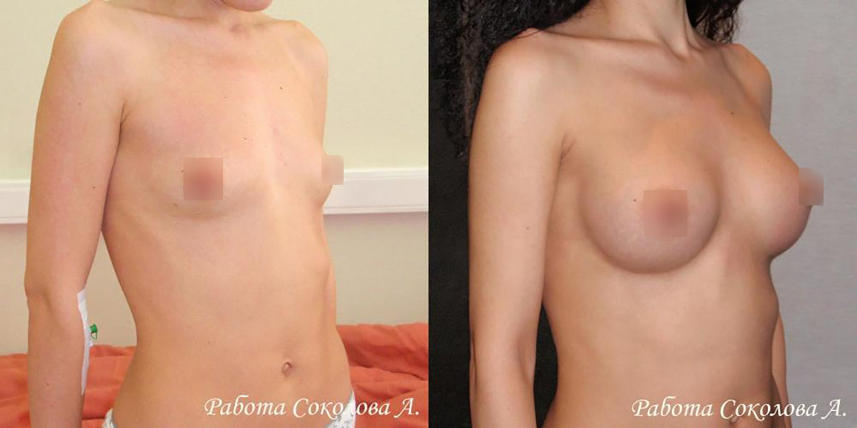 Пластическая хирургия