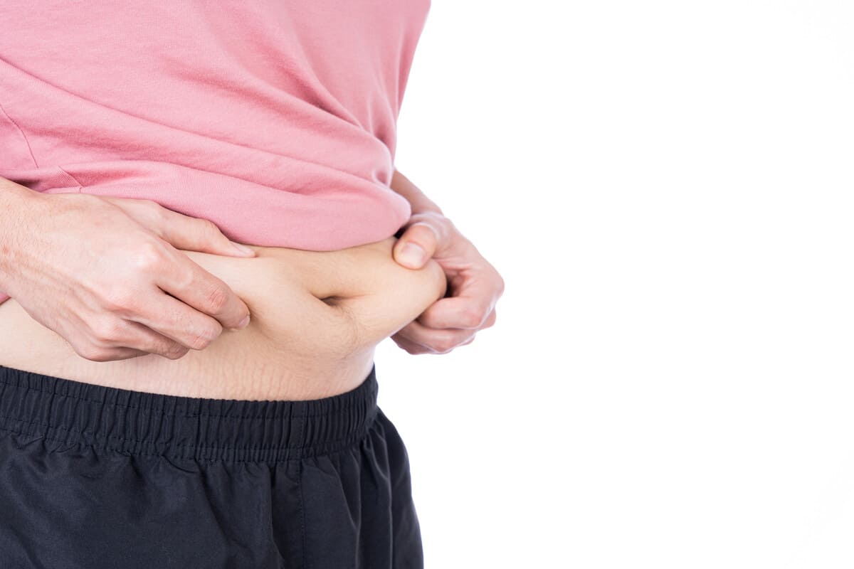 Абдоминопластика