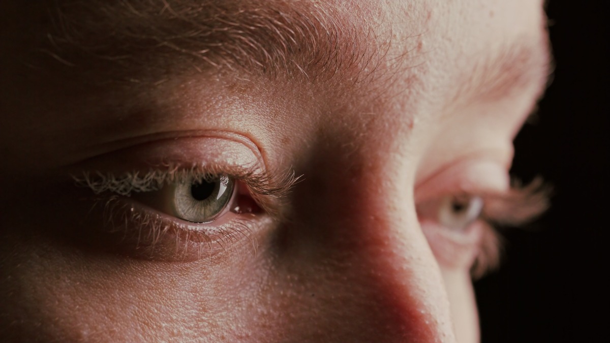 Опускаются брови после блефаропластики