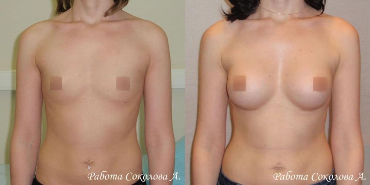 Пластическая хирургия