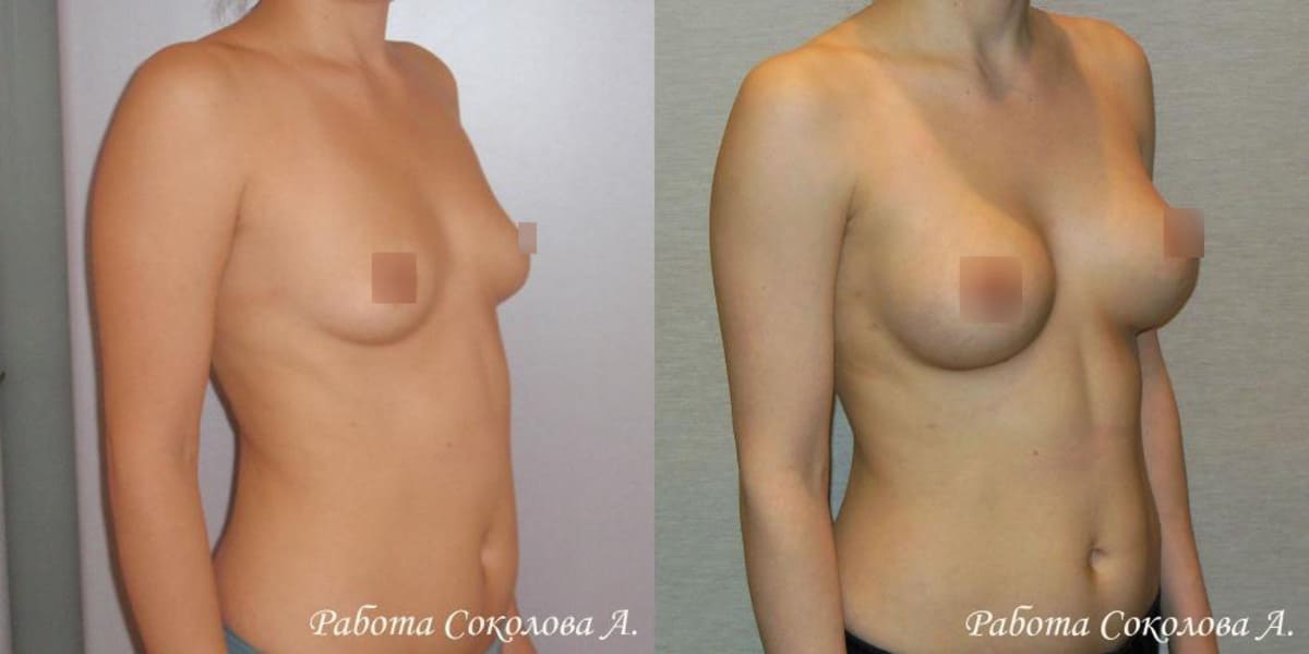 Пластическая хирургия